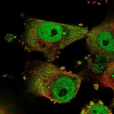 Immunocytochemistry/ Immunofluorescence: GPATCH3 Antibody [NBP2-58803]