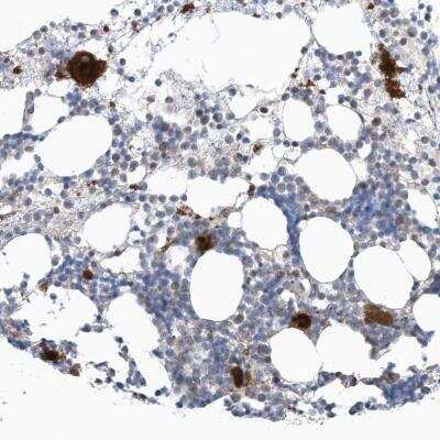 Immunohistochemistry-Paraffin: GPATCH3 Antibody [NBP1-82301]