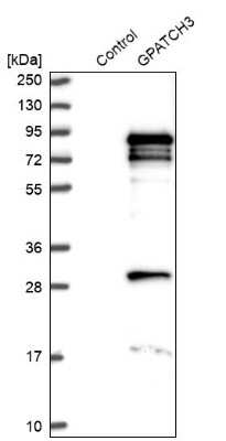 Western Blot: GPATCH3 Antibody [NBP1-82301]