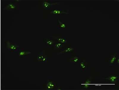Immunocytochemistry/ Immunofluorescence: GPATCH4 Antibody [H00054865-B01P]