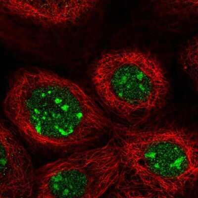 Immunocytochemistry/ Immunofluorescence: GPATCH4 Antibody [NBP2-55313]