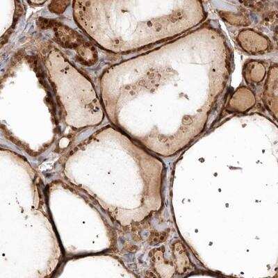 Immunohistochemistry-Paraffin: GPATCH4 Antibody [NBP1-85131]