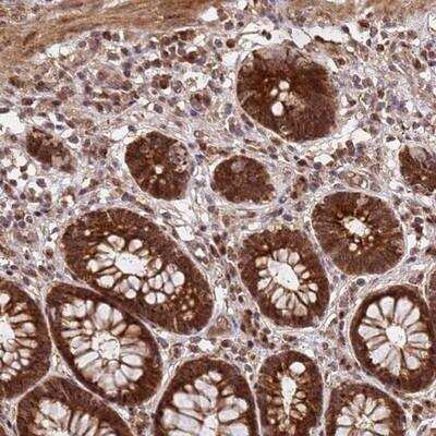 Immunohistochemistry-Paraffin: GPATCH8 Antibody [NBP1-91959]