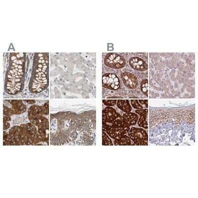 Western Blot: GPD2 Antibody [NBP1-86121]