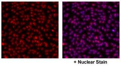 Immunocytochemistry/ Immunofluorescence: GPER/GPR30 Antibody [NBP1-31239]