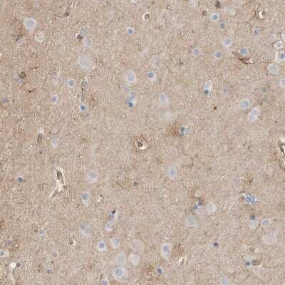 Immunohistochemistry-Paraffin: GPER/GPR30 Antibody [NBP1-88096]
