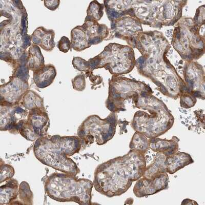 Immunohistochemistry-Paraffin: GPER/GPR30 Antibody [NBP1-88096]