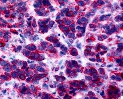 Immunohistochemistry-Paraffin: GPER/GPR30 Antibody - BSA Free [NLS1183]