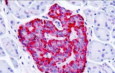 Immunohistochemistry-Paraffin: GPER/GPR30 Antibody - BSA Free [NLS1183]