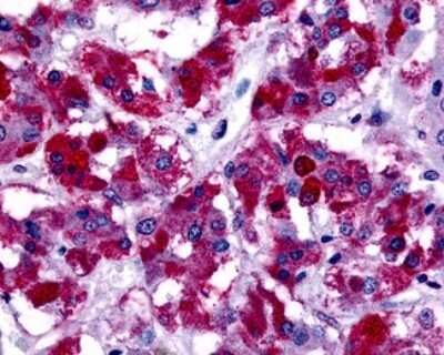 Immunohistochemistry-Paraffin: GPER/GPR30 Antibody - BSA Free [NLS1183]