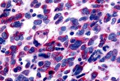 Immunohistochemistry-Paraffin: GPER/GPR30 Antibody - BSA Free [NLS1183]