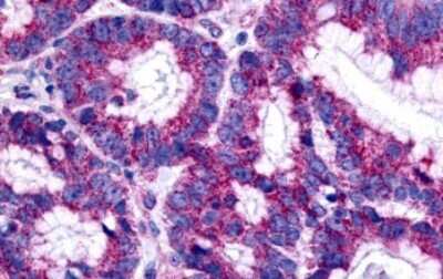 Immunohistochemistry-Paraffin: GPER/GPR30 Antibody - BSA Free [NLS1183]