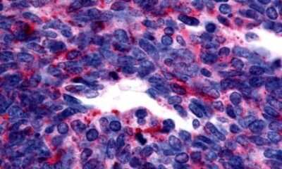 Immunohistochemistry-Paraffin: GPER/GPR30 Antibody - BSA Free [NLS1183]