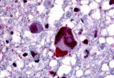 Immunohistochemistry-Paraffin: GPER/GPR30 Antibody - BSA Free [NLS1183]