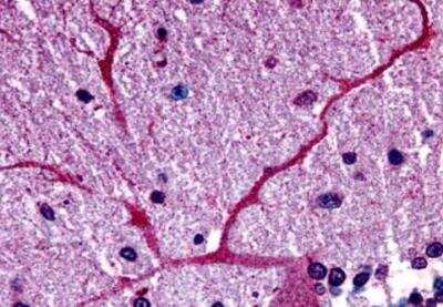 Immunohistochemistry-Paraffin: GPER/GPR30 Antibody - BSA Free [NLS1183]