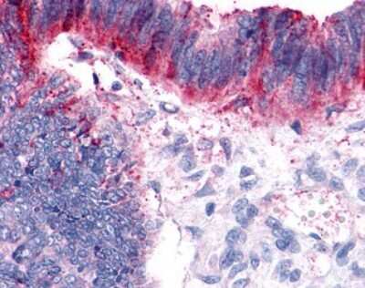 Immunohistochemistry-Paraffin: GPER/GPR30 Antibody - BSA Free [NLS1184]