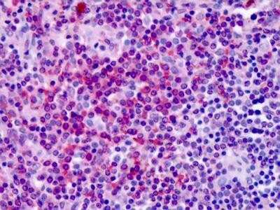 Immunohistochemistry-Paraffin: GPER/GPR30 Antibody - BSA Free [NLS4268]