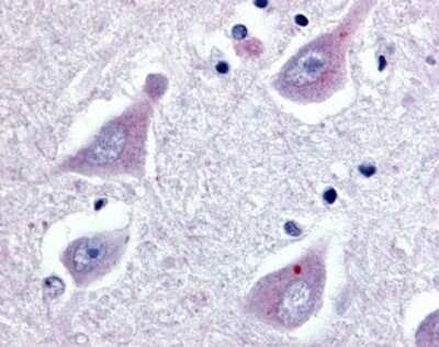 Immunohistochemistry-Paraffin: GPER/GPR30 Antibody - BSA Free [NLS4271]
