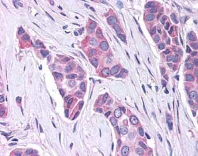 Immunohistochemistry-Paraffin: GPER/GPR30 Antibody - BSA Free [NLS4272]