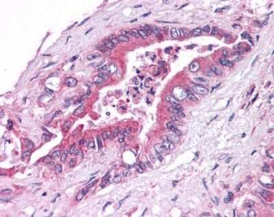 Immunohistochemistry-Paraffin: GPER/GPR30 Antibody - BSA Free [NLS4272]