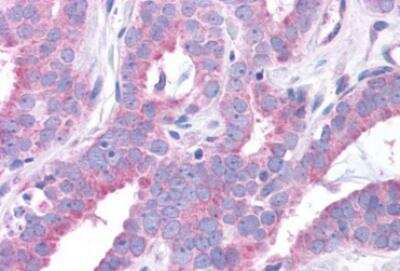 Immunohistochemistry-Paraffin: GPER/GPR30 Antibody - BSA Free [NLS4272]
