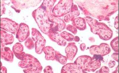 Immunohistochemistry-Paraffin: GPER/GPR30 Antibody - BSA Free [NLS4272]