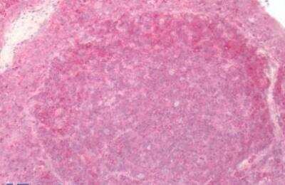 Immunohistochemistry-Paraffin: GPER/GPR30 Antibody - BSA Free [NLS4272]