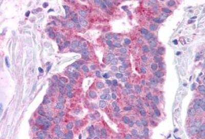 Immunohistochemistry-Paraffin: GPER/GPR30 Antibody - BSA Free [NLS4272]