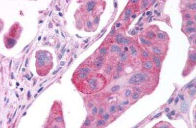 Immunohistochemistry-Paraffin: GPER/GPR30 Antibody - BSA Free [NLS4272]