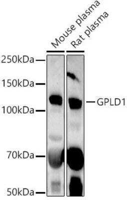 Western Blot: GPI-PLD/GPLD1 AntibodyAzide and BSA Free [NBP3-03599]
