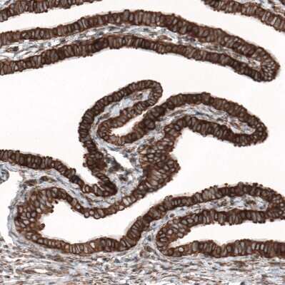 Immunohistochemistry-Paraffin: GPIP137 Antibody [NBP1-88195]