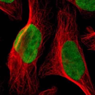 Immunocytochemistry/ Immunofluorescence: GPKOW Antibody [NBP1-81800]