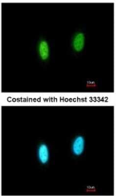 Immunocytochemistry/ Immunofluorescence: GPKOW Antibody [NBP2-16714]