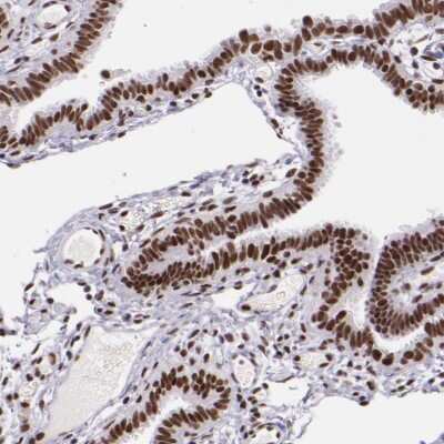 Immunohistochemistry-Paraffin: GPKOW Antibody [NBP1-81800]