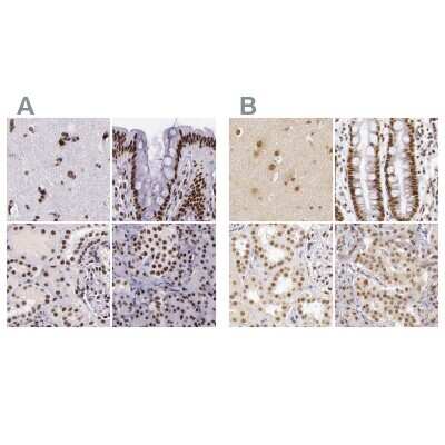 Immunohistochemistry-Paraffin: GPKOW Antibody [NBP1-81800]