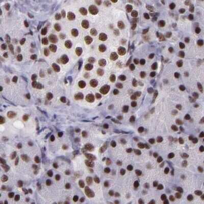 Immunohistochemistry-Paraffin: GPKOW Antibody [NBP1-81800]