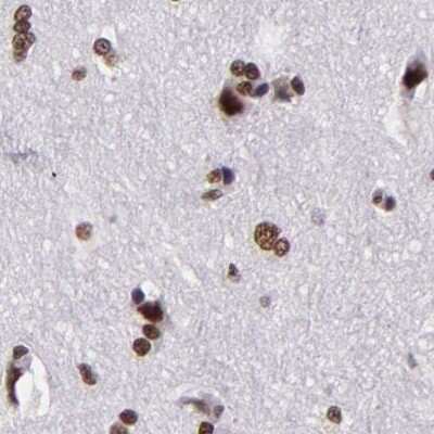 Immunohistochemistry-Paraffin: GPKOW Antibody [NBP1-81800]