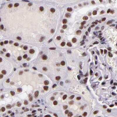 Immunohistochemistry-Paraffin: GPKOW Antibody [NBP1-81800]
