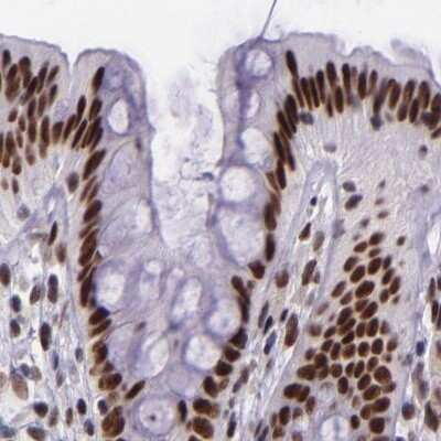 Immunohistochemistry-Paraffin: GPKOW Antibody [NBP1-81800]
