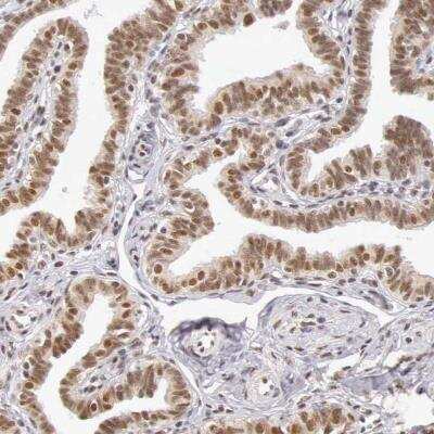 Immunohistochemistry-Paraffin: GPKOW Antibody [NBP1-81801]