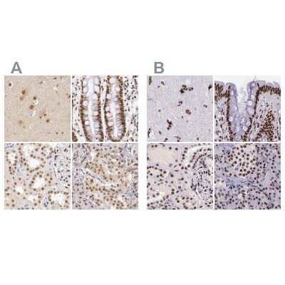 Immunohistochemistry-Paraffin: GPKOW Antibody [NBP1-81801]