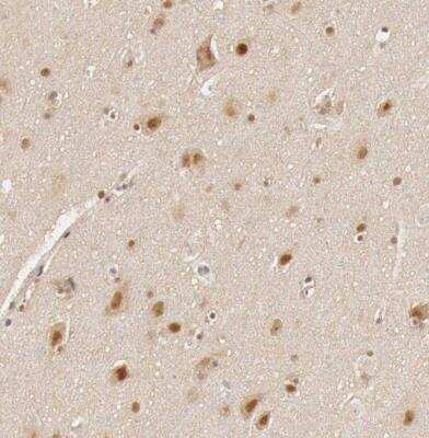 Immunohistochemistry-Paraffin: GPKOW Antibody [NBP1-81801]