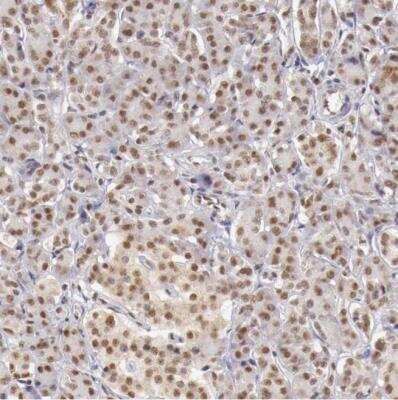 Immunohistochemistry-Paraffin: GPKOW Antibody [NBP1-81801]