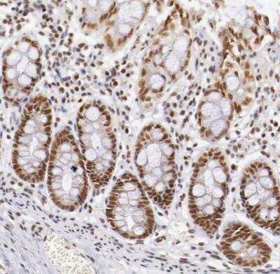 Immunohistochemistry-Paraffin: GPKOW Antibody [NBP1-81801]