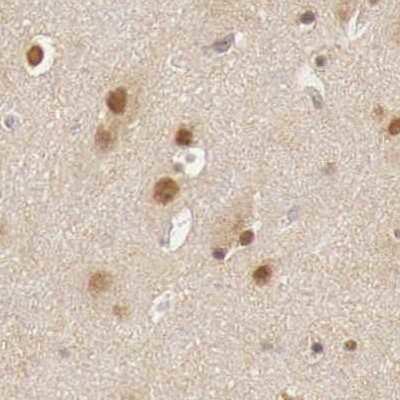 Immunohistochemistry-Paraffin: GPKOW Antibody [NBP1-81801]