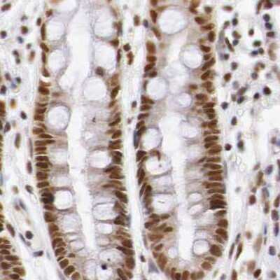 Immunohistochemistry-Paraffin: GPKOW Antibody [NBP1-81801]