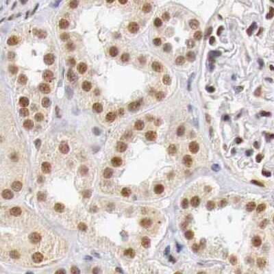 Immunohistochemistry-Paraffin: GPKOW Antibody [NBP1-81801]