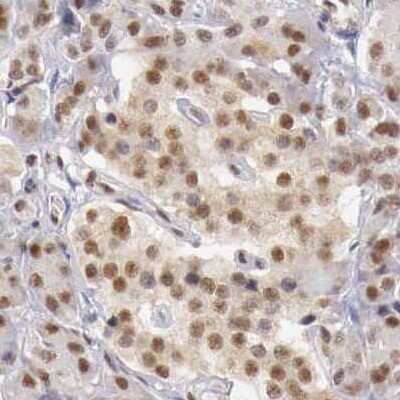 Immunohistochemistry-Paraffin: GPKOW Antibody [NBP1-81801]