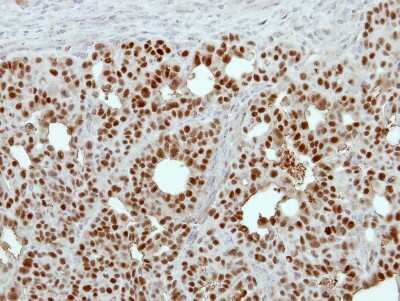 Immunohistochemistry-Paraffin: GPKOW Antibody [NBP2-16713]