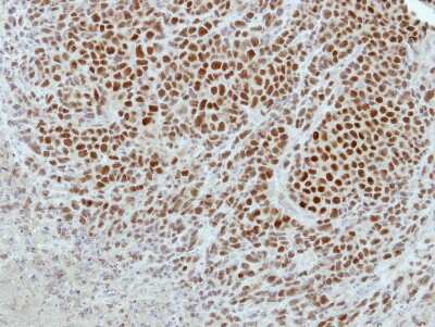 Immunohistochemistry-Paraffin: GPKOW Antibody [NBP2-16714]